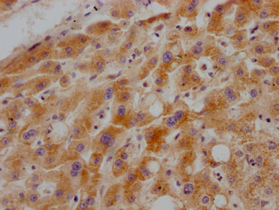 IHC image of RAC07379 diluted at 1:100 and staining in paraffin-embedded human liver tissue performed on a Leica BondTM system. After dewaxing and hydration, antigen retrieval was mediated by high pressure in a citrate buffer (pH 6.0). Section was blocked with 10% normal goat serum 30min at RT. Then primary antibody (1% BSA) was incubated at 4? overnight. The primary is detected by a Goat anti-rabbit IgG polymer labeled by HRP and visualized using 0.05% DAB.