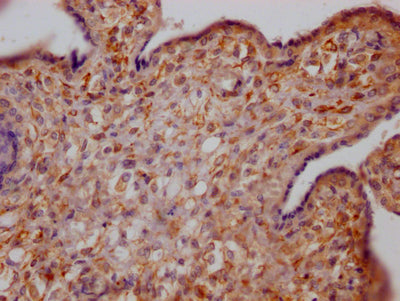 IHC image of RAC07379 diluted at 1:100 and staining in paraffin-embedded human placenta tissue performed on a Leica BondTM system. After dewaxing and hydration, antigen retrieval was mediated by high pressure in a citrate buffer (pH 6.0). Section was blocked with 10% normal goat serum 30min at RT. Then primary antibody (1% BSA) was incubated at 4? overnight. The primary is detected by a Goat anti-rabbit IgG polymer labeled by HRP and visualized using 0.05% DAB.