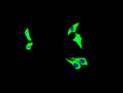 Immunofluorescence staining of HepG2 Cells with RAC07379 at 1:50, counter-stained with DAPI. The cells were fixed in 4% formaldehyde and blocked in 10% normal Goat Serum. The cells were then incubated with the antibody overnight at 4?. Nuclear DNA was labeled in blue with DAPI. The secondary antibody was FITC-conjugated AffiniPure Goat Anti-Rabbit IgG (H+L).