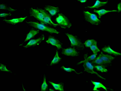 Immunofluorescence staining of Hela Cells with RAC07381 at 1:50, counter-stained with DAPI. The cells were fixed in 4% formaldehyde, permeated by 0.2% TritonX-100, and blocked in 10% normal Goat Serum. The cells were then incubated with the antibody overnight at 4?. Nuclear DNA was labeled in blue with DAPI. The secondary antibody was FITC-conjugated AffiniPure Goat Anti-Rabbit IgG (H+L).