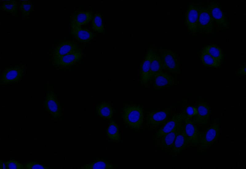 Immunofluorescence staining of HepG2 with RAC07382 at 1:50, counter-stained with DAPI. The cells were fixed in 4% formaldehyde and blocked in 10% normal Goat Serum. The cells were then incubated with the antibody overnight at 4Â°C. The secondary antibody was Alexa Fluor 510-congugated AffiniPure Goat Anti-Rabbit IgG(H+L).