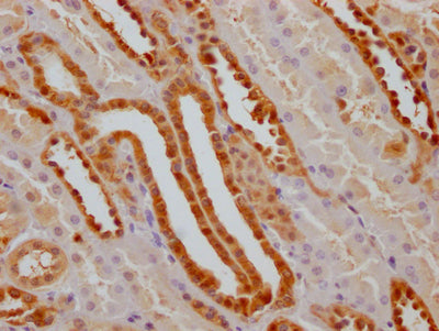 IHC image of RAC07383 diluted at 1:100 and staining in paraffin-embedded human kidney tissue performed on a Leica BondTM system. After dewaxing and hydration, antigen retrieval was mediated by high pressure in a citrate buffer (pH 6.0). Section was blocked with 10% normal goat serum 30min at RT. Then primary antibody (1% BSA) was incubated at 4? overnight. The primary is detected by a Goat anti-rabbit IgG polymer labeled by HRP and visualized using 0.05% DAB.