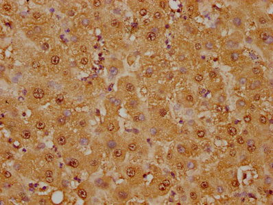 IHC image of RAC07384 diluted at 1:125 and staining in paraffin-embedded human liver tissue performed on a Leica BondTM system. After dewaxing and hydration, antigen retrieval was mediated by high pressure in a citrate buffer (pH 6.0). Section was blocked with 10% normal goat serum 30min at RT. Then primary antibody (1% BSA) was incubated at 4? overnight. The primary is detected by a biotinylated secondary antibody and visualized using an HRP conjugated SP system.