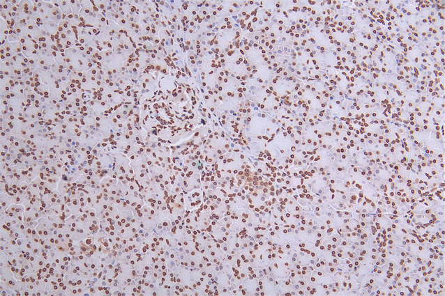 IHC image of RAC07386 diluted at 1:50 and staining in paraffin-embedded human pancreati tissue performed on a Leica BondTM system. After dewaxing and hydration, antigen retrieval was mediated by high pressure in a citrate buffer (pH 6.0). Section was blocked with 10% normal goat serum 30min at RT. Then primary antibody (1% BSA) was incubated at 4Â°C overnight. The primary is detected by a Goat anti-rabbit polymer IgG labeled by HRP and visualized using 0.27% DAB.