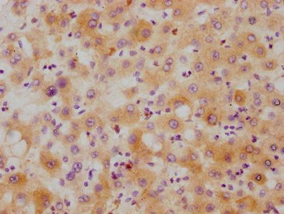 IHC image of RAC07387 diluted at 1:215 and staining in paraffin-embedded human liver tissue performed on a Leica BondTM system. After dewaxing and hydration, antigen retrieval was mediated by high pressure in a citrate buffer (pH 6.0). Section was blocked with 10% normal goat serum 30min at RT. Then primary antibody (1% BSA) was incubated at 4? overnight. The primary is detected by a biotinylated secondary antibody and visualized using an HRP conjugated SP system.