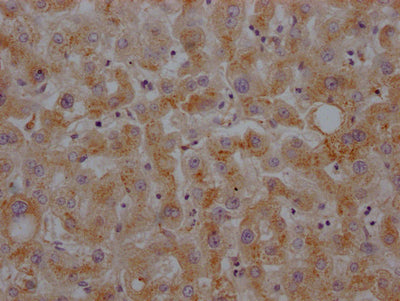 IHC image of RAC07388 diluted at 1:100 and staining in paraffin-embedded human liver tissue performed on a Leica BondTM system. After dewaxing and hydration, antigen retrieval was mediated by high pressure in a citrate buffer (pH 6.0). Section was blocked with 10% normal goat serum 30min at RT. Then primary antibody (1% BSA) was incubated at 4? overnight. The primary is detected by a Goat anti-rabbit IgG polymer labeled by HRP and visualized using 0.05% DAB.