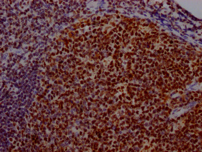 IHC image of RAC07389 diluted at 1:100 and staining in paraffin-embedded human tonsil tissue performed on a Leica BondTM system. After dewaxing and hydration, antigen retrieval was mediated by high pressure in a citrate buffer (pH 6.0). Section was blocked with 10% normal goat serum 30min at RT. Then primary antibody (1% BSA) was incubated at 4? overnight. The primary is detected by a Goat anti-rabbit IgG polymer labeled by HRP and visualized using 0.05% DAB.