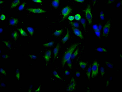 Immunofluorescence staining of Hela Cells with RAC07389 at 1:50, counter-stained with DAPI. The cells were fixed in 4% formaldehyde, permeated by 0.2% TritonX-100, and blocked in 10% normal Goat Serum. The cells were then incubated with the antibody overnight at 4?. Nuclear DNA was labeled in blue with DAPI. The secondary antibody was FITC-conjugated AffiniPure Goat Anti-Rabbit IgG (H+L).