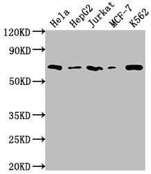 Western Blot; Positive WB detected in: Hela whole cell lysate, HepG2 whole cell lysate, Jurkat whole cell lysate, MCF-7 whole cell lysate, K562 whole cell lysate; All lanes: HDAC2 antibody at 1:2000; Secondary; Goat polyclonal to rabbit IgG at 1/50000 dilution; Predicted band size: 56, 52 kDa; Observed band size: 60 kDa