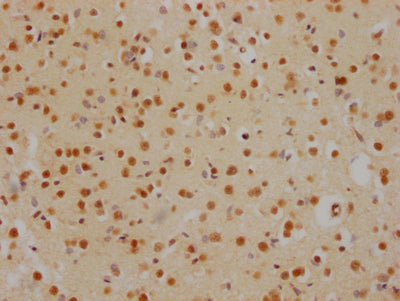 IHC image of RAC07391 diluted at 1:100 and staining in paraffin-embedded human brain tissue performed on a Leica BondTM system. After dewaxing and hydration, antigen retrieval was mediated by high pressure in a citrate buffer (pH 6.0). Section was blocked with 10% normal goat serum 30min at RT. Then primary antibody (1% BSA) was incubated at 4? overnight. The primary is detected by a Goat anti-rabbit IgG polymer labeled by HRP and visualized using 0.05% DAB.