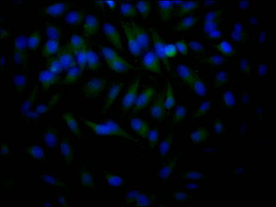 Immunofluorescence staining of Hela Cells with RAC07391 at 1:50, counter-stained with DAPI. The cells were fixed in 4% formaldehyde, permeated by 0.2% TritonX-100, and blocked in 10% normal Goat Serum. The cells were then incubated with the antibody overnight at 4?. Nuclear DNA was labeled in blue with DAPI. The secondary antibody was FITC-conjugated AffiniPure Goat Anti-Rabbit IgG (H+L).