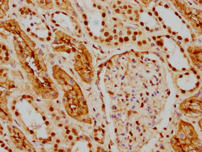 IHC image of RAC07394 diluted at 1:154 and staining in paraffin-embedded human kidney tissue performed on a Leica BondTM system. After dewaxing and hydration, antigen retrieval was mediated by high pressure in a citrate buffer (pH 6.0). Section was blocked with 10% normal goat serum 30min at RT. Then primary antibody (1% BSA) was incubated at 4? overnight. The primary is detected by a biotinylated secondary antibody and visualized using an HRP conjugated SP system.
