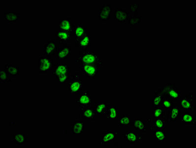Immunofluorescence staining of Hela cells with RAC07394 at 1:51, counter-stained with DAPI. The cells were fixed in 4% formaldehyde, permeabilized using 0.2% Triton X-100 and blocked in 10% normal Goat Serum. The cells were then incubated with the antibody overnight at 4?. The secondary antibody was Alexa Fluor 488-congugated AffiniPure Goat Anti-Rabbit IgG (H+L).