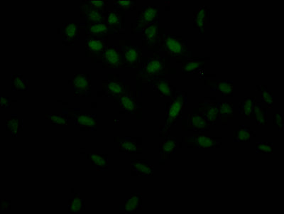 Immunofluorescence staining of Hela Cells with RAC07396 at 1:50, counter-stained with DAPI. The cells were fixed in 4% formaldehyde, permeated by 0.2% TritonX-100, and blocked in 10% normal Goat Serum. The cells were then incubated with the antibody overnight at 4?. Nuclear DNA was labeled in blue with DAPI. The secondary antibody was FITC-conjugated AffiniPure Goat Anti-Rabbit IgG (H+L).