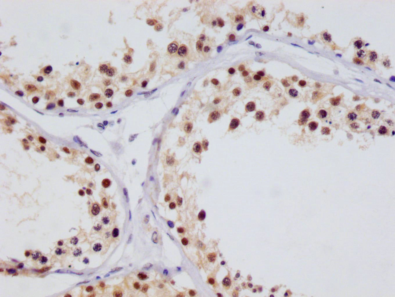 IHC image of RAC07397 diluted at 1:100 and staining in paraffin-embedded human testis tissue performed on a Leica BondTM system. After dewaxing and hydration, antigen retrieval was mediated by high pressure in a citrate buffer (pH 6.0). Section was blocked with 10% normal goat serum 30min at RT. Then primary antibody (1% BSA) was incubated at 4Â°C overnight. The primary is detected by a Goat anti-rabbit polymer IgG labeled by HRP and visualized using 0.05% DAB.