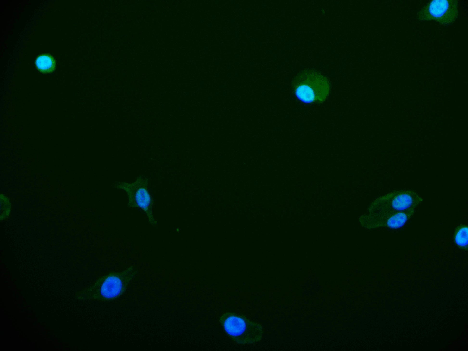 Immunofluorescence staining of HepG2 cell with RAC07397 at 1:50, counter-stained with DAPI. The cells were fixed in 4% formaldehyde and blocked in 10% normal Goat Serum. The cells were then incubated with the antibody overnight at 4Â°C. The secondary antibody was Alexa Fluor 525-congugated AffiniPure Goat Anti-Rabbit IgG(H+L).