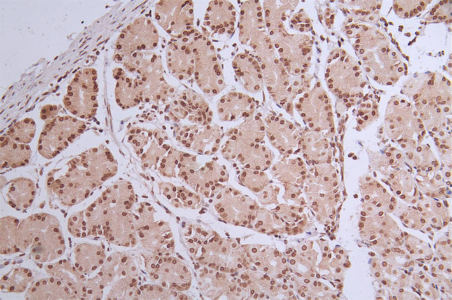 IHC image of RAC07399 diluted at 1:50 and staining in paraffin-embedded human stomach tissue performed on a Leica BondTM system. After dewaxing and hydration, antigen retrieval was mediated by high pressure in a citrate buffer (pH 6.0). Section was blocked with 10% normal goat serum 30min at RT. Then primary antibody (1% BSA) was incubated at 4Â°C overnight. The primary is detected by a Goat anti-rabbit polymer IgG labeled by HRP and visualized using 0.32% DAB.