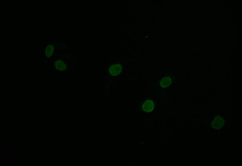 Immunofluorescence staining of Hela with RAC07399 at 1:30, counter-stained with DAPI. The cells were fixed in 4% formaldehyde and blocked in 10% normal Goat Serum. The cells were then incubated with the antibody overnight at 4Â°C. The secondary antibody was Alexa Fluor 504-congugated AffiniPure Goat Anti-Rabbit IgG(H+L).