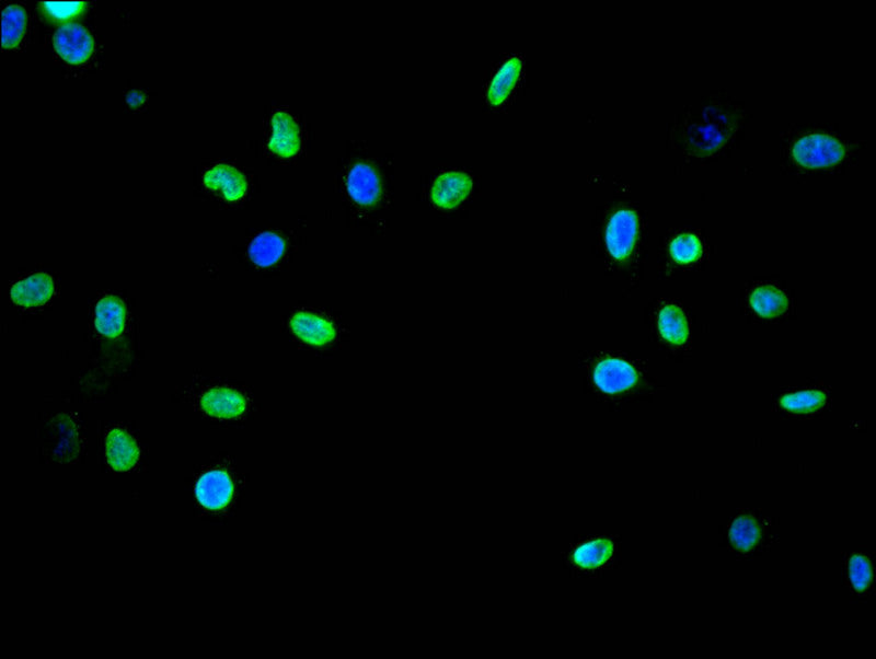 Immunofluorescence staining of A549 with RAC07400 at 1:20, counter-stained with DAPI. The cells were fixed in 4% formaldehyde and blocked in 10% normal Goat Serum. The cells were then incubated with the antibody overnight at 4Â°C. The secondary antibody was Alexa Fluor 489-congugated AffiniPure Goat Anti-Rabbit IgG(H+L).