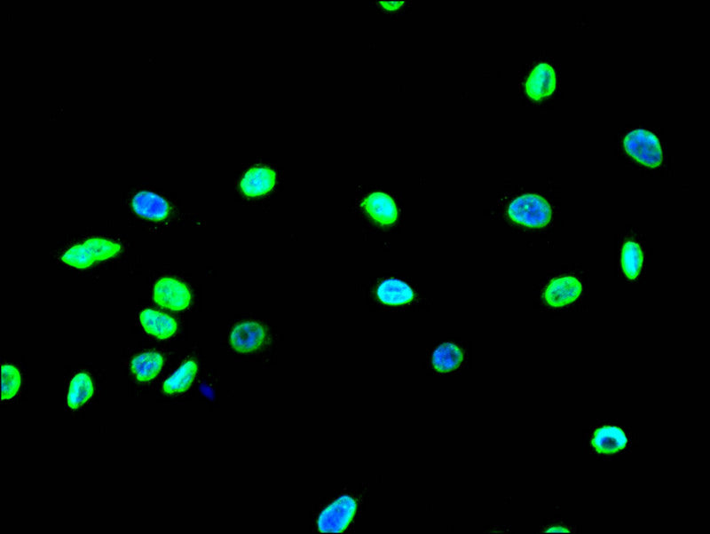Immunofluorescence staining of A549 with RAC07401 at 1:10, counter-stained with DAPI. The cells were fixed in 4% formaldehyde and blocked in 10% normal Goat Serum. The cells were then incubated with the antibody overnight at 4Â°C. The secondary antibody was Alexa Fluor 490-congugated AffiniPure Goat Anti-Rabbit IgG(H+L).