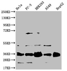 Western Blot; Positive WB detected in: Hela whole cell lysate, PC-3 whole cell lysate, HEK293 whole cell lysate, A549 whole cell lysate, HepG2 whole cell lysate; All lanes: HMGCL antibody at 1:1000; Secondary; Goat polyclonal to rabbit IgG at 1/50000 dilution; Predicted band size: 35, 27, 21 kDa; Observed band size: 35 kDa