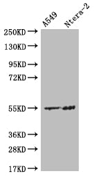 Western Blot; Positive WB detected in: A549 whole cell lysate, Ntera-2 whole cell lysate; All lanes: HMGCS2 antibody at 1:500; Secondary; Goat polyclonal to rabbit IgG at 1/50000 dilution; Predicted band size: 57, 53, 51 kDa; Observed band size: 55 kDa