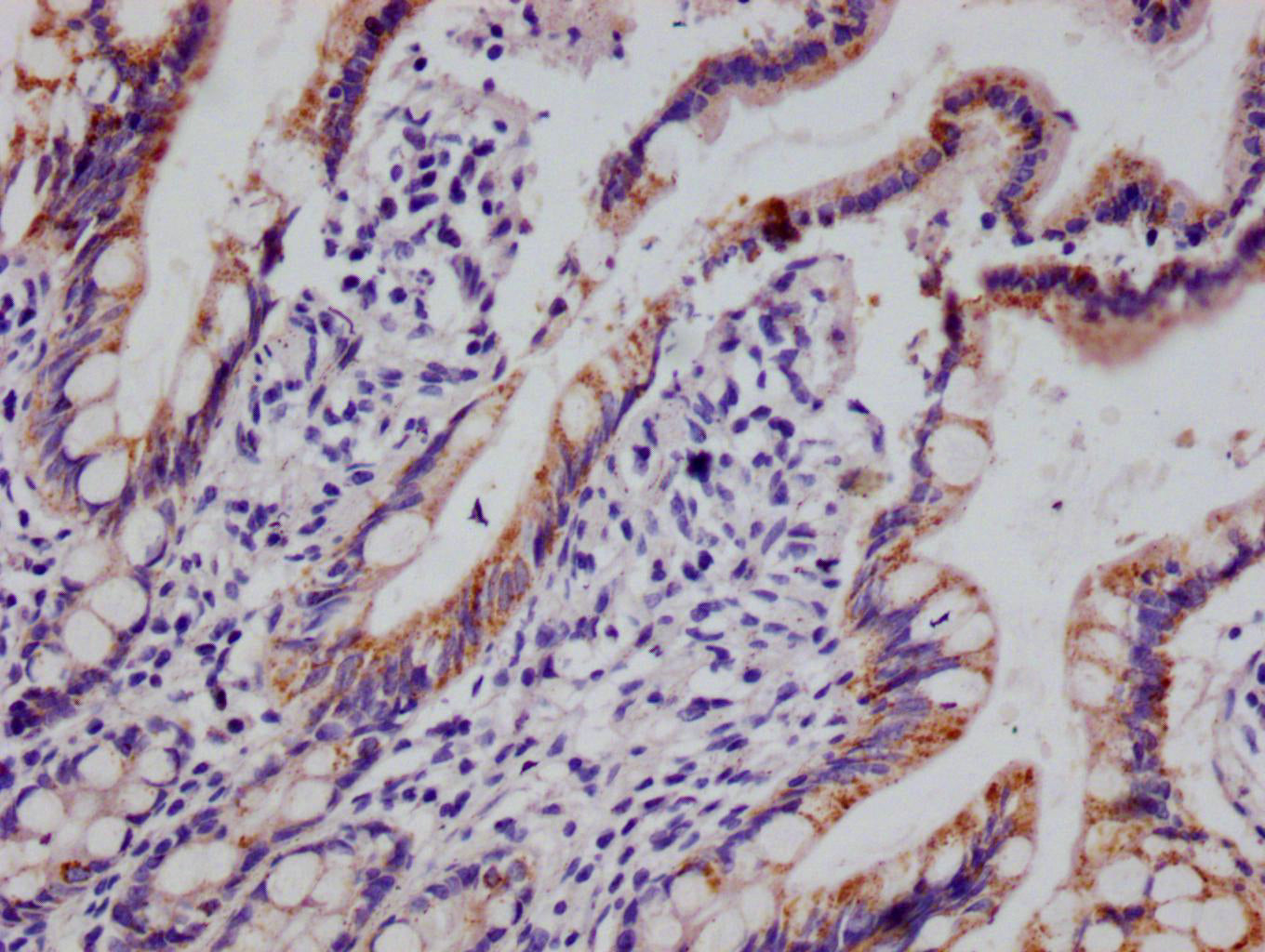 IHC image of RAC07408 diluted at 1:100 and staining in paraffin-embedded human small intestine tissue performed on a Leica BondTM system. After dewaxing and hydration, antigen retrieval was mediated by high pressure in a citrate buffer (pH 6.0). Section was blocked with 10% normal goat serum 30min at RT. Then primary antibody (1% BSA) was incubated at 4Â°C overnight. The primary is detected by a Goat anti-rabbit polymer IgG labeled by HRP and visualized using 0.05% DAB.