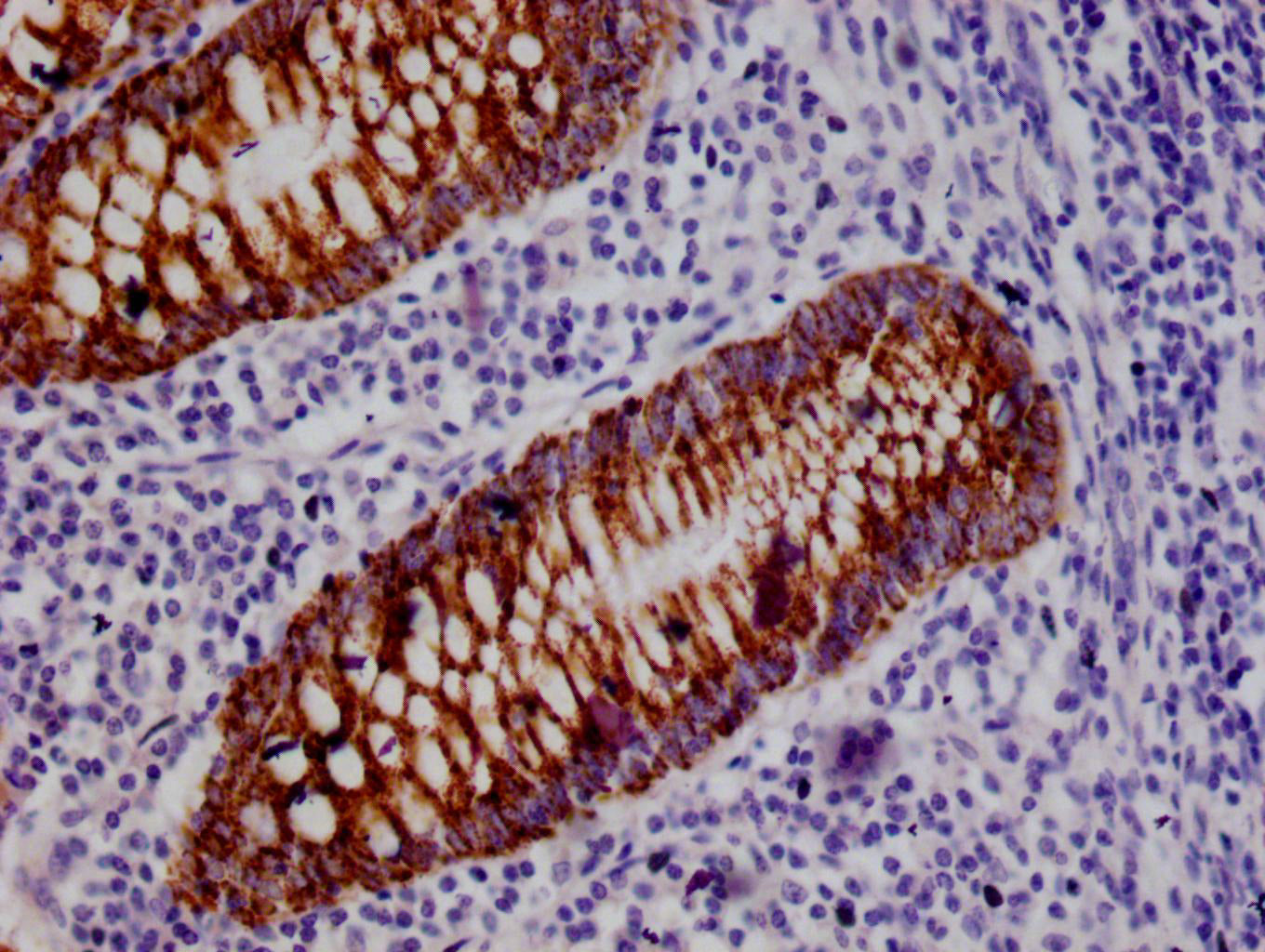 IHC image of RAC07408 diluted at 1:100 and staining in paraffin-embedded human appendix tissue performed on a Leica BondTM system. After dewaxing and hydration, antigen retrieval was mediated by high pressure in a citrate buffer (pH 6.0). Section was blocked with 10% normal goat serum 30min at RT. Then primary antibody (1% BSA) was incubated at 4Â°C overnight. The primary is detected by a Goat anti-rabbit polymer IgG labeled by HRP and visualized using 0.05% DAB.