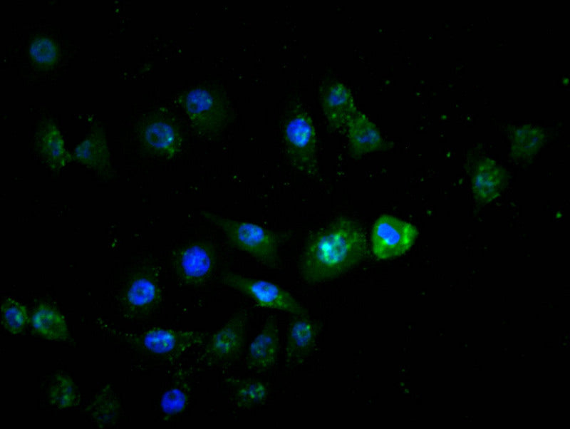 Immunofluorescence staining of MCF-7 with RAC07409 at 1:20, counter-stained with DAPI. The cells were fixed in 4% formaldehyde and blocked in 10% normal Goat Serum. The cells were then incubated with the antibody overnight at 4Â°C. The secondary antibody was Alexa Fluor 526-congugated AffiniPure Goat Anti-Rabbit IgG(H+L).