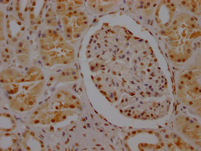 IHC image of RAC07410 diluted at 1:100 and staining in paraffin-embedded human kidney tissue performed on a Leica BondTM system. After dewaxing and hydration, antigen retrieval was mediated by high pressure in a citrate buffer (pH 6.0). Section was blocked with 10% normal goat serum 30min at RT. Then primary antibody (1% BSA) was incubated at 4? overnight. The primary is detected by a Goat anti-rabbit IgG polymer labeled by HRP and visualized using 0.05% DAB.