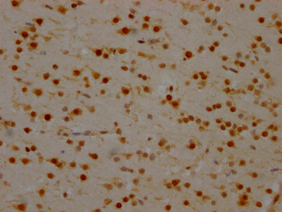 IHC image of RAC07410 diluted at 1:100 and staining in paraffin-embedded human brain tissue performed on a Leica BondTM system. After dewaxing and hydration, antigen retrieval was mediated by high pressure in a citrate buffer (pH 6.0). Section was blocked with 10% normal goat serum 30min at RT. Then primary antibody (1% BSA) was incubated at 4? overnight. The primary is detected by a Goat anti-rabbit IgG polymer labeled by HRP and visualized using 0.05% DAB.