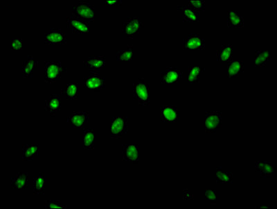 Immunofluorescence staining of Hela Cells with RAC07410 at 1:50, counter-stained with DAPI. The cells were fixed in 4% formaldehyde, permeated by 0.2% TritonX-100, and blocked in 10% normal Goat Serum. The cells were then incubated with the antibody overnight at 4?. Nuclear DNA was labeled in blue with DAPI. The secondary antibody was FITC-conjugated AffiniPure Goat Anti-Rabbit IgG (H+L).