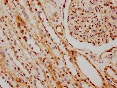 IHC image of RAC07411 diluted at 1:66.35 and staining in paraffin-embedded human kidney tissue performed on a Leica BondTM system. After dewaxing and hydration, antigen retrieval was mediated by high pressure in a citrate buffer (pH 6.0). Section was blocked with 10% normal goat serum 30min at RT. Then primary antibody (1% BSA) was incubated at 4? overnight. The primary is detected by a biotinylated secondary antibody and visualized using an HRP conjugated SP system.