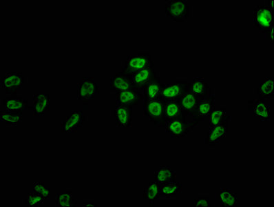Immunofluorescence staining of Hela cells with RAC07411 at 1:22, counter-stained with DAPI. The cells were fixed in 4% formaldehyde, permeabilized using 0.2% Triton X-100 and blocked in 10% normal Goat Serum. The cells were then incubated with the antibody overnight at 4?. The secondary antibody was Alexa Fluor 488-congugated AffiniPure Goat Anti-Rabbit IgG (H+L).
