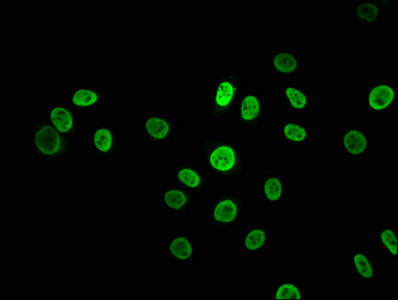 Immunofluorescence staining of A549 cells with RAC07412 at 1:43.5, counter-stained with DAPI. The cells were fixed in 4% formaldehyde, permeabilized using 0.2% Triton X-100 and blocked in 10% normal Goat Serum. The cells were then incubated with the antibody overnight at 4?. The secondary antibody was Alexa Fluor 488-congugated AffiniPure Goat Anti-Rabbit IgG (H+L).