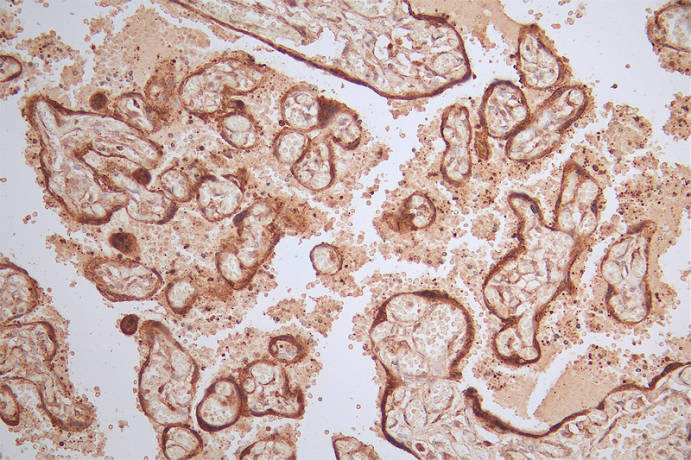 IHC image of RAC07414 diluted at 1:100 and staining in paraffin-embedded human placenta tissue performed on a Leica BondTM system. After dewaxing and hydration, antigen retrieval was mediated by high pressure in a citrate buffer (pH 6.0). Section was blocked with 10% normal goat serum 30min at RT. Then primary antibody (1% BSA) was incubated at 4Â°C overnight. The primary is detected by a Goat anti-rabbit polymer IgG labeled by HRP and visualized using 0.50% DAB.
