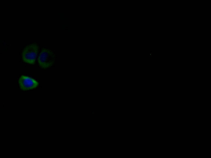Immunofluorescence staining of Hela with RAC07414 at 1:50, counter-stained with DAPI. The cells were fixed in 4% formaldehyde and blocked in 10% normal Goat Serum. The cells were then incubated with the antibody overnight at 4Â°C. The secondary antibody was Alexa Fluor 514-congugated AffiniPure Goat Anti-Rabbit IgG(H+L).