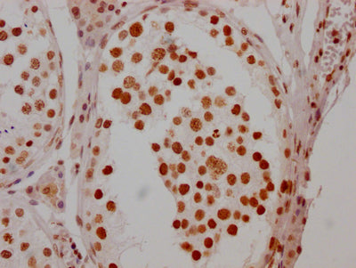 IHC image of RAC07415 diluted at 1:100 and staining in paraffin-embedded human testis tissue performed on a Leica BondTM system. After dewaxing and hydration, antigen retrieval was mediated by high pressure in a citrate buffer (pH 6.0). Section was blocked with 10% normal goat serum 30min at RT. Then primary antibody (1% BSA) was incubated at 4? overnight. The primary is detected by a Goat anti-rabbit IgG polymer labeled by HRP and visualized using 0.05% DAB.