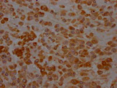 IHC image of RAC07416 diluted at 1:100 and staining in paraffin-embedded human placenta tissue performed on a Leica BondTM system. After dewaxing and hydration, antigen retrieval was mediated by high pressure in a citrate buffer (pH 6.0). Section was blocked with 10% normal goat serum 30min at RT. Then primary antibody (1% BSA) was incubated at 4? overnight. The primary is detected by a Goat anti-rabbit IgG polymer labeled by HRP and visualized using 0.05% DAB.