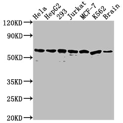 Western Blot; Positive WB detected in: Hela whole cell lysate, HepG2 whole cell lysate, 293 whole cell lysate, Jurkat whole cell lysate, MCF-7 whole cell lysate, K562 whole cell lysate, Mouse brain tissue; All lanes: HSPD1 antibody at 1:2000; Secondary; Goat polyclonal to rabbit IgG at 1/50000 dilution; Predicted band size: 62, 18 kDa; Observed band size: 60 kDa