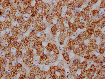 IHC image of RAC07417 diluted at 1:100 and staining in paraffin-embedded human liver tissue performed on a Leica BondTM system. After dewaxing and hydration, antigen retrieval was mediated by high pressure in a citrate buffer (pH 6.0). Section was blocked with 10% normal goat serum 30min at RT. Then primary antibody (1% BSA) was incubated at 4? overnight. The primary is detected by a Goat anti-rabbit IgG polymer labeled by HRP and visualized using 0.05% DAB.
