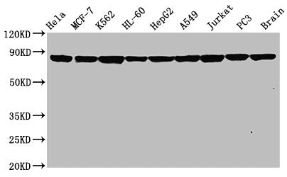 Western Blot; Positive WB detected in: Hela whole cell lysate, MCF-7 whole cell lysate, K562 whole cell lysate, HL-60 whole cell lysate, HepG2 whole cell lysate, A549 whole cell lysate, Jurkat whole cell lysate, PC3 whole cell lysate, Rat brain tissue; All lanes: Hsp90 alpha antibody at 0.8ug/ml; Secondary; Goat polyclonal to rabbit IgG at 1/50000 dilution; Predicted band size: 85, 99 KDa; Observed band size: 85 KDa