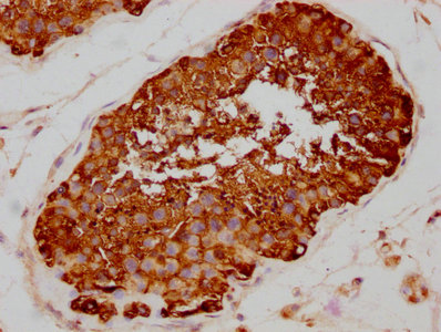 IHC image of RAC07418 diluted at 1:80 and staining in paraffin-embedded human testis tissue performed on a Leica BondTM system. After dewaxing and hydration, antigen retrieval was mediated by high pressure in a citrate buffer (pH 6.0). Section was blocked with 10% normal goat serum 30min at RT. Then primary antibody (1% BSA) was incubated at 4? overnight. The primary is detected by a biotinylated secondary antibody and visualized using an HRP conjugated SP system.