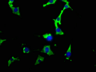 Immunofluorescence staining of NIH/3T3 cells with RAC07418 at 1:26, counter-stained with DAPI. The cells were fixed in 4% formaldehyde, permeabilized using 0.2% Triton X-100 and blocked in 10% normal Goat Serum. The cells were then incubated with the antibody overnight at 4?. The secondary antibody was Alexa Fluor 488-congugated AffiniPure Goat Anti-Rabbit IgG (H+L).