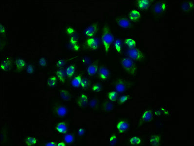 Immunofluorescence staining of Hela cells with RAC07419 at 1:29, counter-stained with DAPI. The cells were fixed in 4% formaldehyde, permeabilized using 0.2% Triton X-100 and blocked in 10% normal Goat Serum. The cells were then incubated with the antibody overnight at 4?. The secondary antibody was Alexa Fluor 488-congugated AffiniPure Goat Anti-Rabbit IgG (H+L).