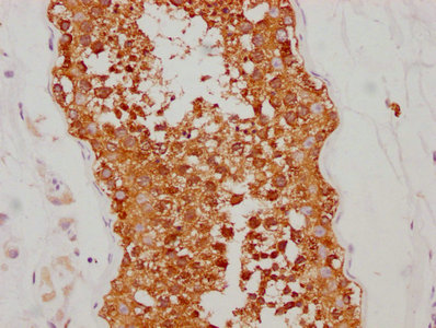 IHC image of RAC07420 diluted at 1:190 and staining in paraffin-embedded human testis tissue performed on a Leica BondTM system. After dewaxing and hydration, antigen retrieval was mediated by high pressure in a citrate buffer (pH 6.0). Section was blocked with 10% normal goat serum 30min at RT. Then primary antibody (1% BSA) was incubated at 4? overnight. The primary is detected by a biotinylated secondary antibody and visualized using an HRP conjugated SP system.