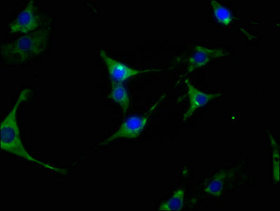 Immunofluorescence staining of NIH/3T3 cells with RAC07420 at 1:63, counter-stained with DAPI. The cells were fixed in 4% formaldehyde, permeabilized using 0.2% Triton X-100 and blocked in 10% normal Goat Serum. The cells were then incubated with the antibody overnight at 4?. The secondary antibody was Alexa Fluor 488-congugated AffiniPure Goat Anti-Rabbit IgG (H+L).