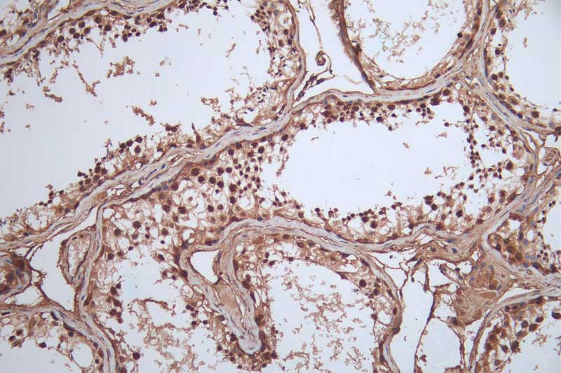 IHC image of RAC07421 diluted at 1:100 and staining in paraffin-embedded human testis tissue performed on a Leica BondTM system. After dewaxing and hydration, antigen retrieval was mediated by high pressure in a citrate buffer (pH 6.0). Section was blocked with 10% normal goat serum 30min at RT. Then primary antibody (1% BSA) was incubated at 4Â°C overnight. The primary is detected by a Goat anti-rabbit polymer IgG labeled by HRP and visualized using 0.05% DAB.
