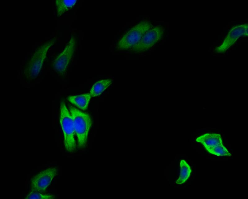 Immunofluorescence staining of HepG2 cell with RAC07421 at 1:50, counter-stained with DAPI. The cells were fixed in 4% formaldehyde and blocked in 10% normal Goat Serum. The cells were then incubated with the antibody overnight at 4Â°C. The secondary antibody was Alexa Fluor 495-congugated AffiniPure Goat Anti-Rabbit IgG(H+L).