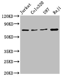 Western Blot; Positive WB detected in: Jurkat whole cell lysate, Colo320 whole cell lysate, U87 whole cell lysate, Raji whole cell lysate; All lanes: HSPA8 antibody at 1.72ug/ml; Secondary; Goat polyclonal to rabbit IgG at 1/50000 dilution; Predicted band size: 71, 54 KDa; Observed band size: 71 KDa